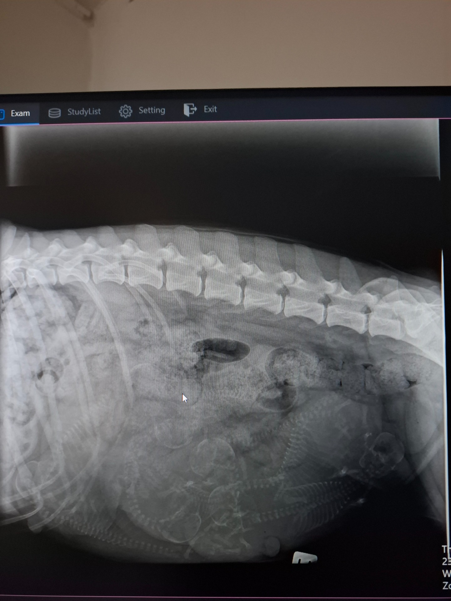 8 stk sagde røntgenbilledet. 